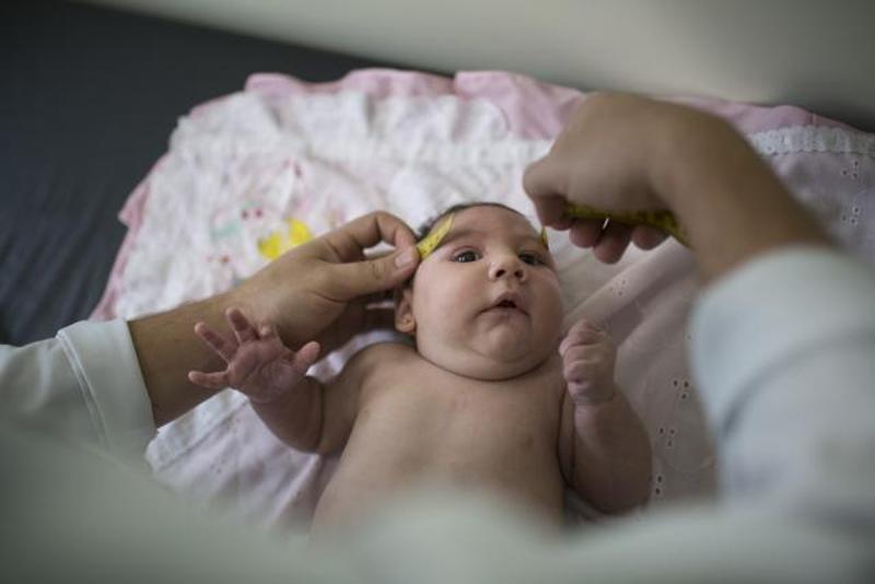 brazil-zika-birth virus